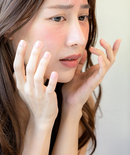 赤み